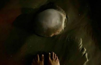 הקשר בין מדוזה לתלונות